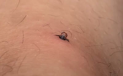 Carrapatos no Jardim do Condomínio: Como Evitar Infestações Silenciosas